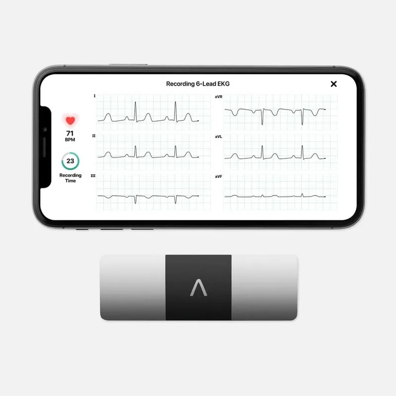 KardiaMobile Medical-Grade 6L EKG Heart Monitor