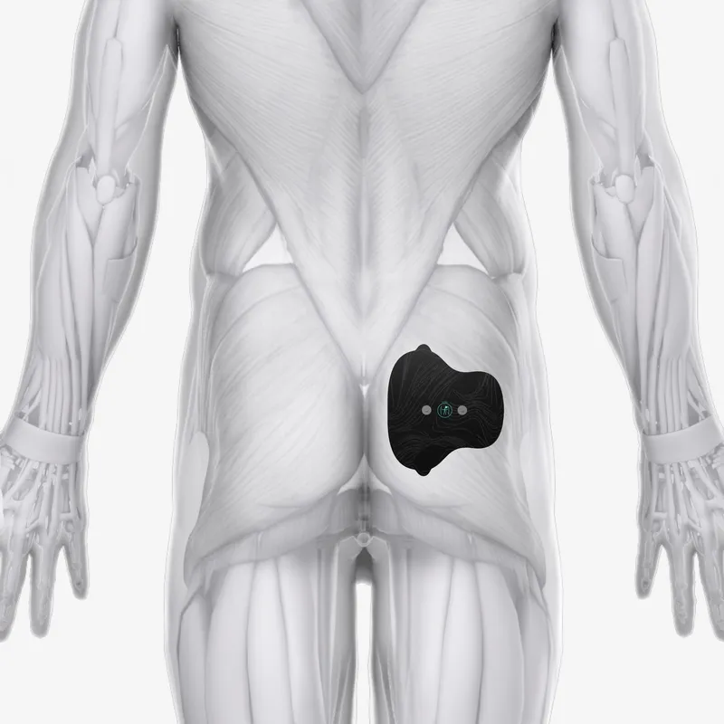 Halo Glute Pad Set 6-Pack